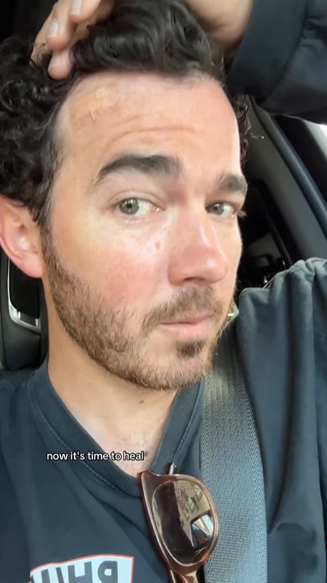 ​Kevin Jonas ha sido operado de un cáncer de piel 