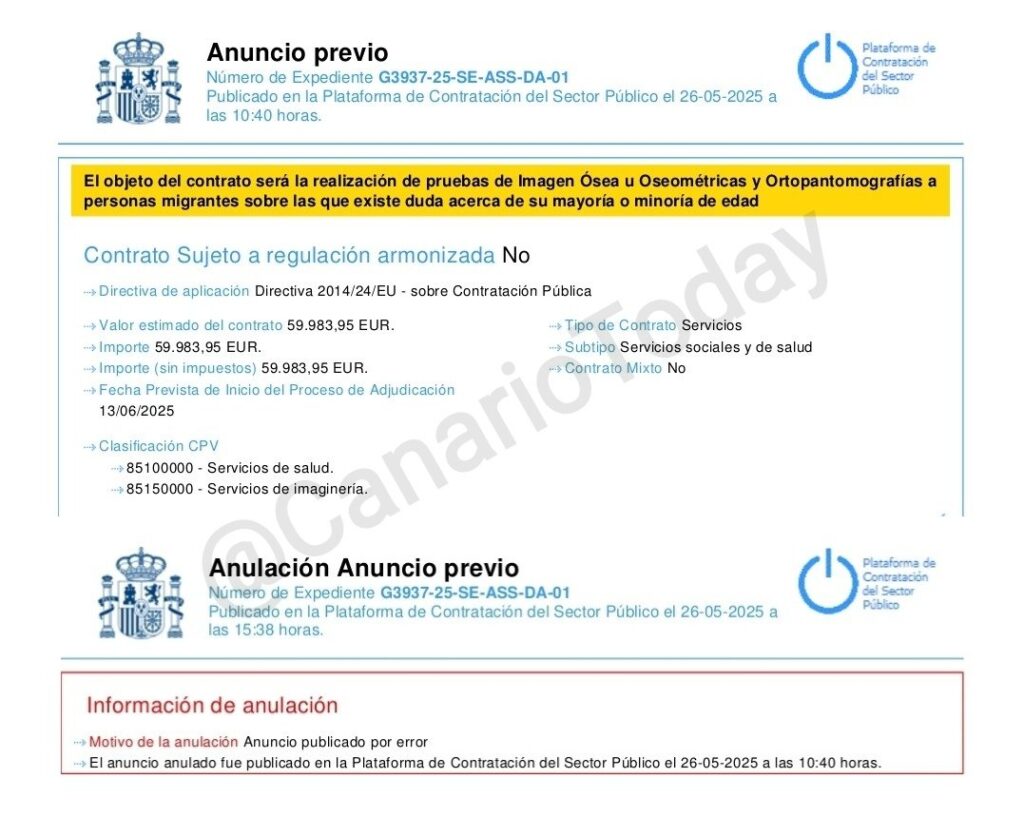 Sanidad anula un contrato para pruebas de edad a inmigrantes ilegales en Tenerife tras un error de publicación