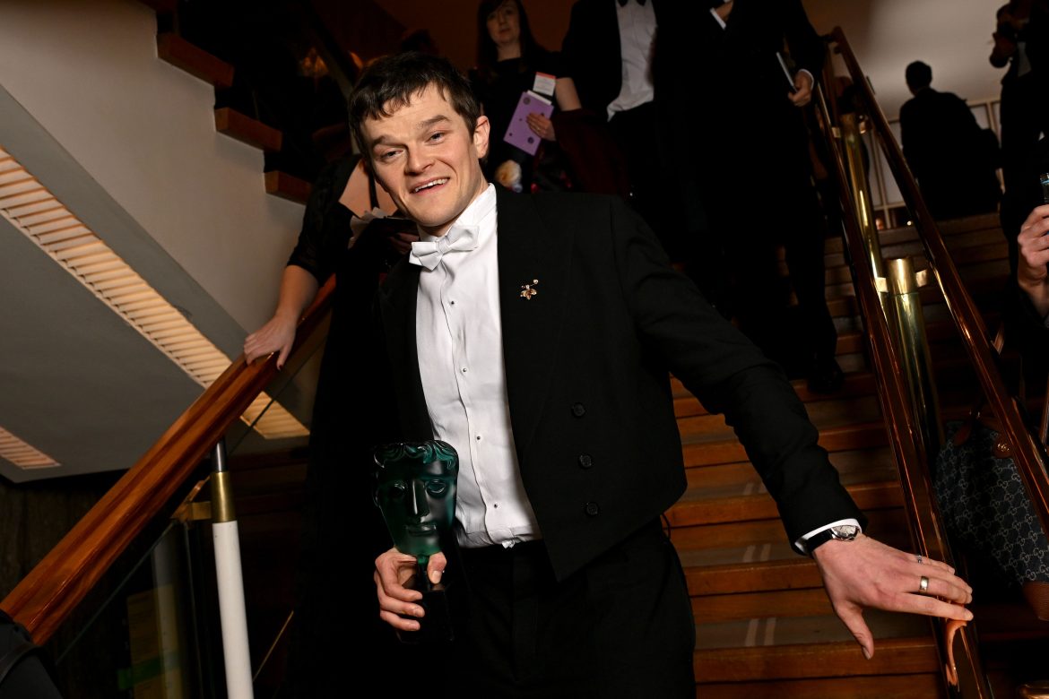 ​Robert Aramayo, el actor de abuelo vasco que dejó a Leonardo DiCaprio y Timothée Chalamet sin BAFTA 