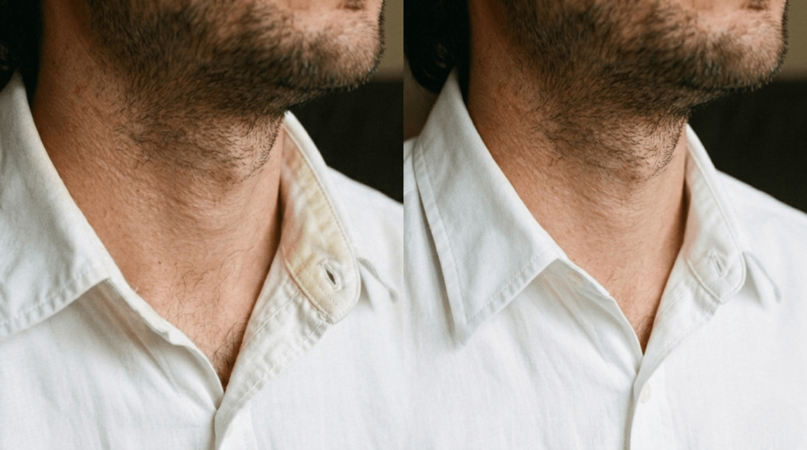 Cómo eliminar manchas de sudor amarillentas en el cuello de las camisas en 5 pasos