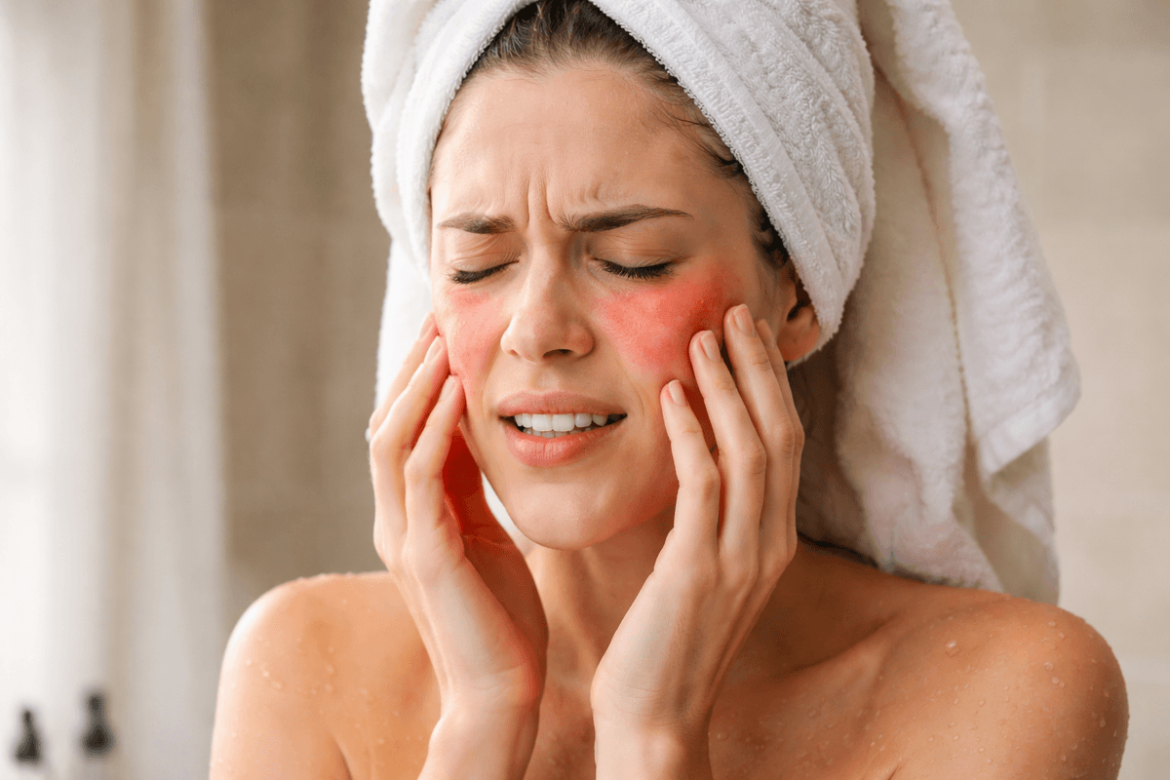 Piel tirante y con picor después de la ducha: 5 cuidados contra el agua dura