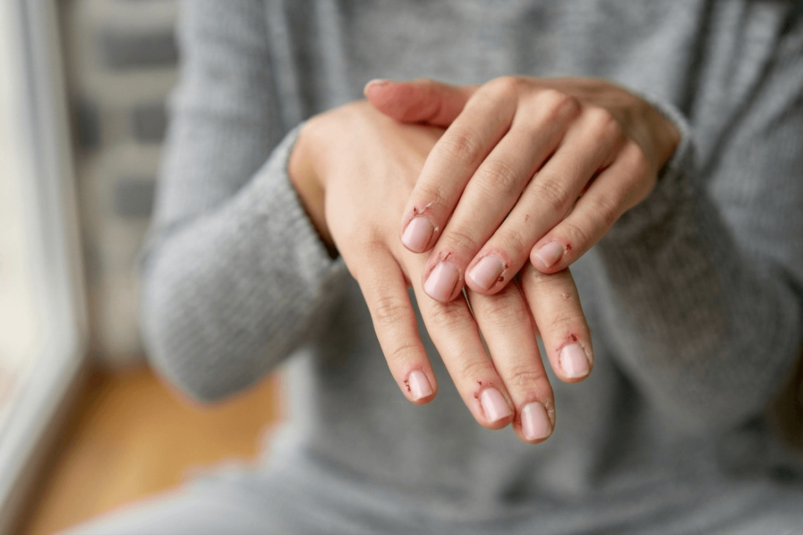 ¿Te salen padrastros de seguido? Estos 7 errores con las cutículas los están causando